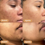 Load image into Gallery viewer, Masque au collagène - Anti taches, bouton, visage gras (PROMO FÊTE DES MÈRES - Stock presqu'épuisé)