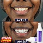 Load image into Gallery viewer, Glory Smile - élimine les odeurs, taches et blanchit les dents (Résultat Garantie - Dernières pièces restantes)
