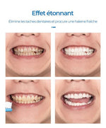 Load image into Gallery viewer, LANBENA-Mousse de blanchiment des dents  (EN PROMOTION - Stock très limité)
