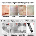 Load image into Gallery viewer, Aspirateur points noirs dernière génération (EN PROMOTION - Stock très limité)
